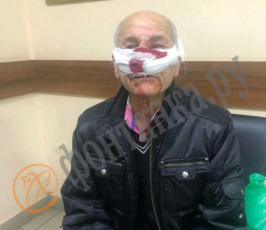 Пенсионеру зашили нос и сделали томограмму. Фото: fontanka.ru